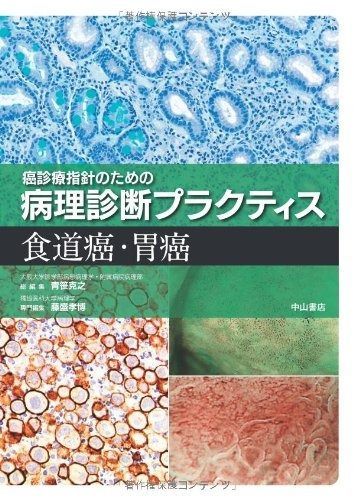 食道癌・胃癌 (癌診療指針のための病理診断プラクティス) 【公式通販】