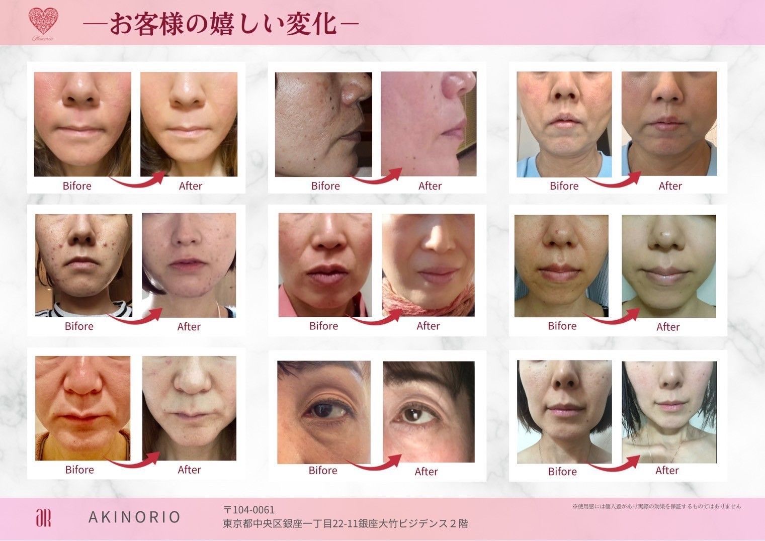 アキノリオ　クリアクリスタルセラム、KIHADAセラム クリアクリスタルセラム | アキノリオ