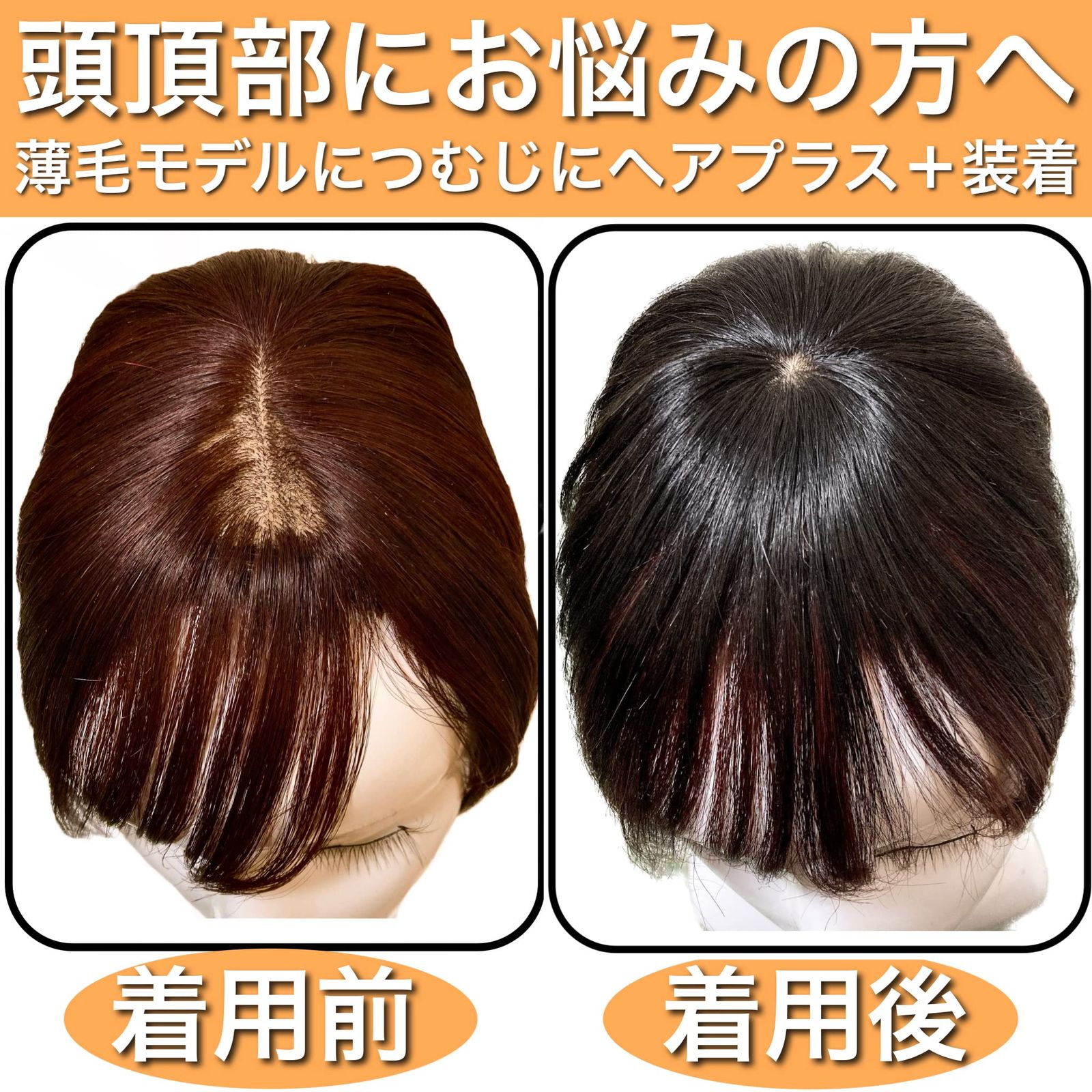 フォンテーヌ VALAN 医療用 ロングウイッグ 超美品 レディース