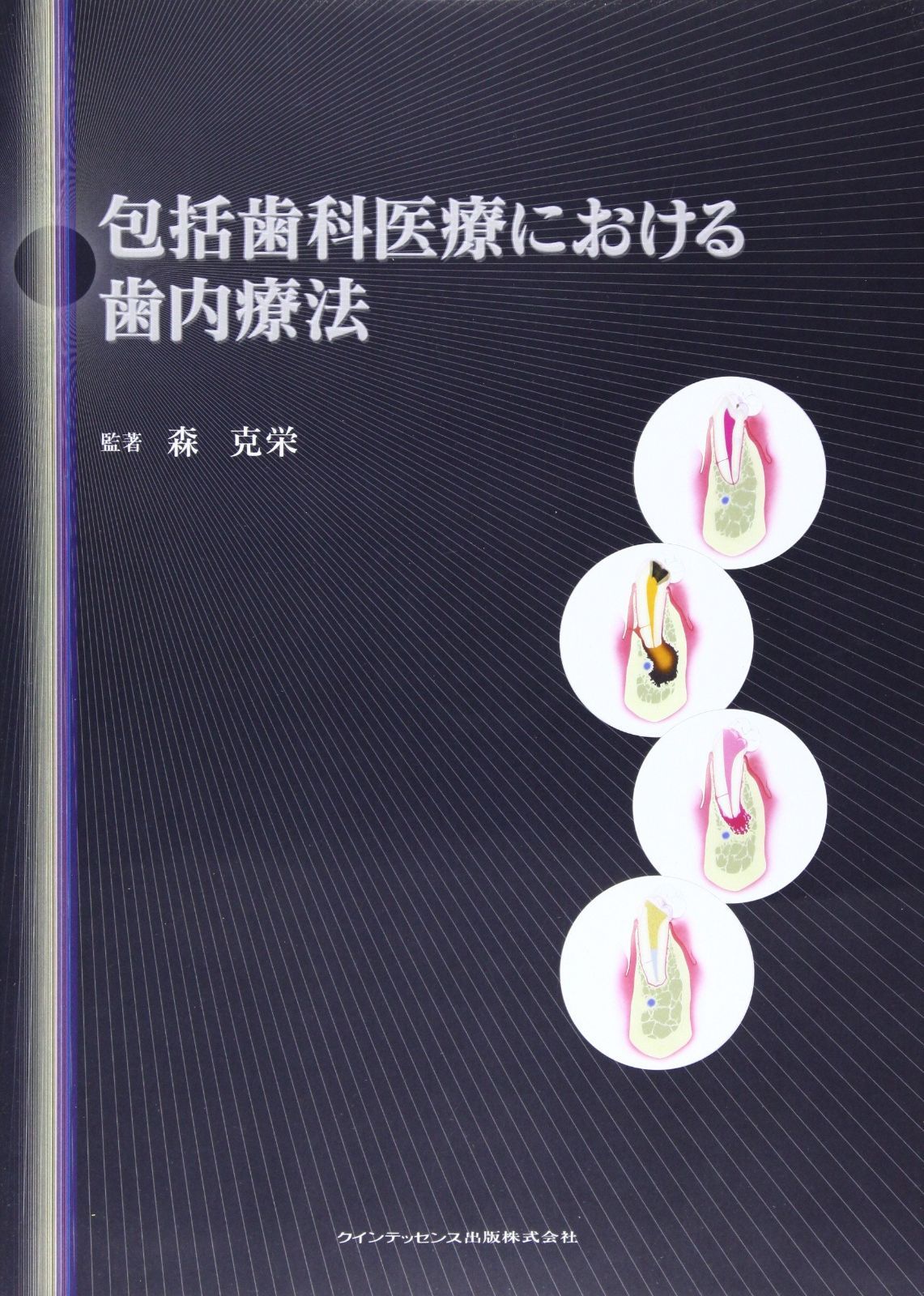 包括歯科医療における歯内療法