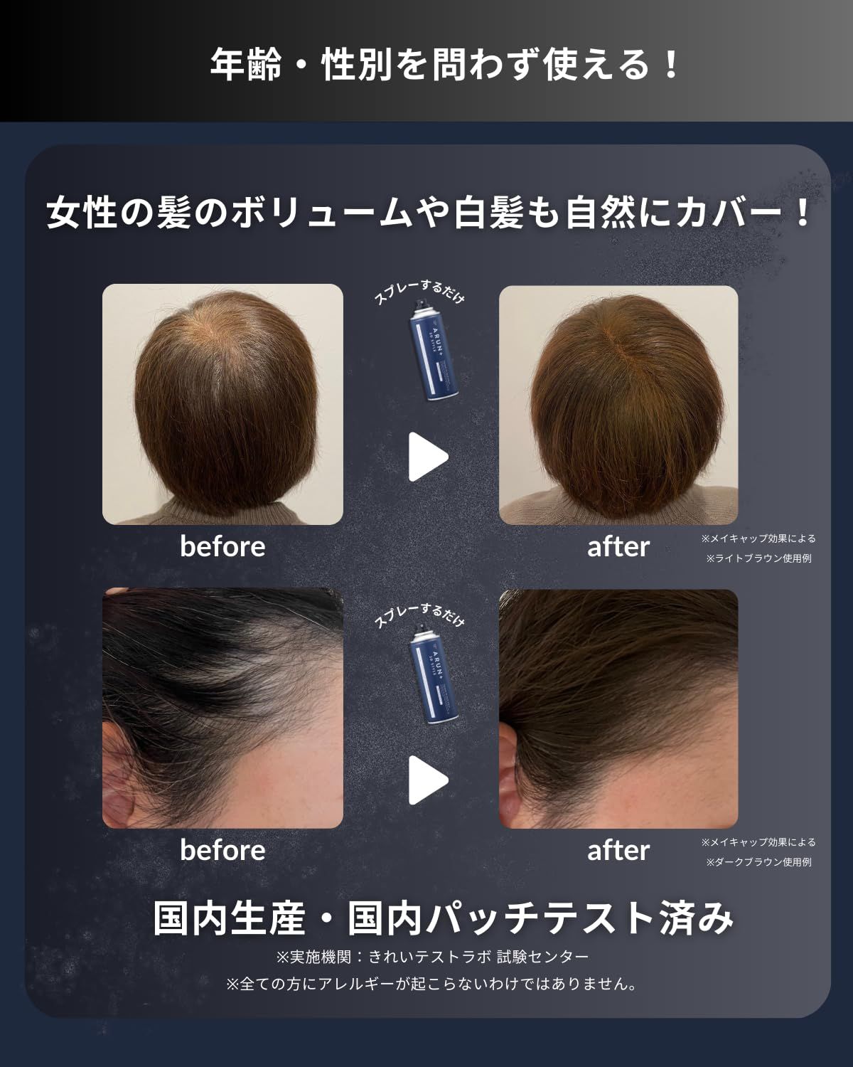 日本製 薄毛隠し