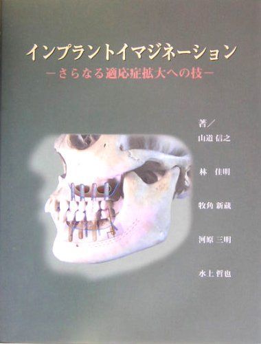 インプラントイマジネーション―さらなる適応症拡大への技 [大型本 