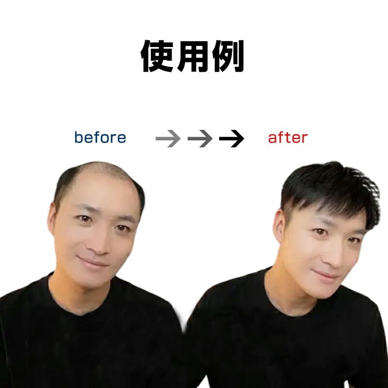ボリュームアップ