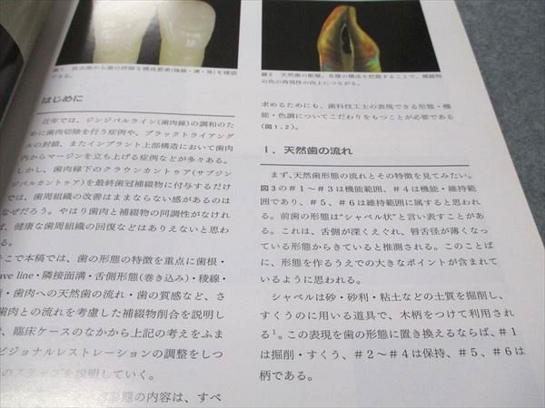 【裁断済み】インプラント材料 Q&A マテリアル・クリニカル編　2冊セット 本 【裁断済み】インプラント材料 Q&A マテリアル・クリニカル編 2冊セット