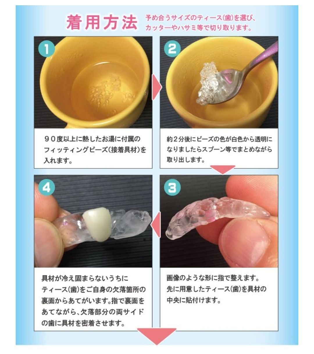 ワイヤー トゥース 差し歯 ホワイトニング 仮歯 - その他