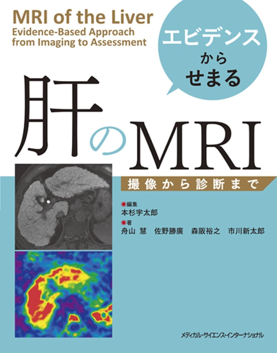 エビデンスからせまる 肝のMRI - 撮像から診断まで -