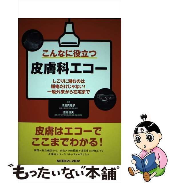 こんなに役立つ皮膚科エコー しこりに潜むのは腫瘍だけじゃない! 一般