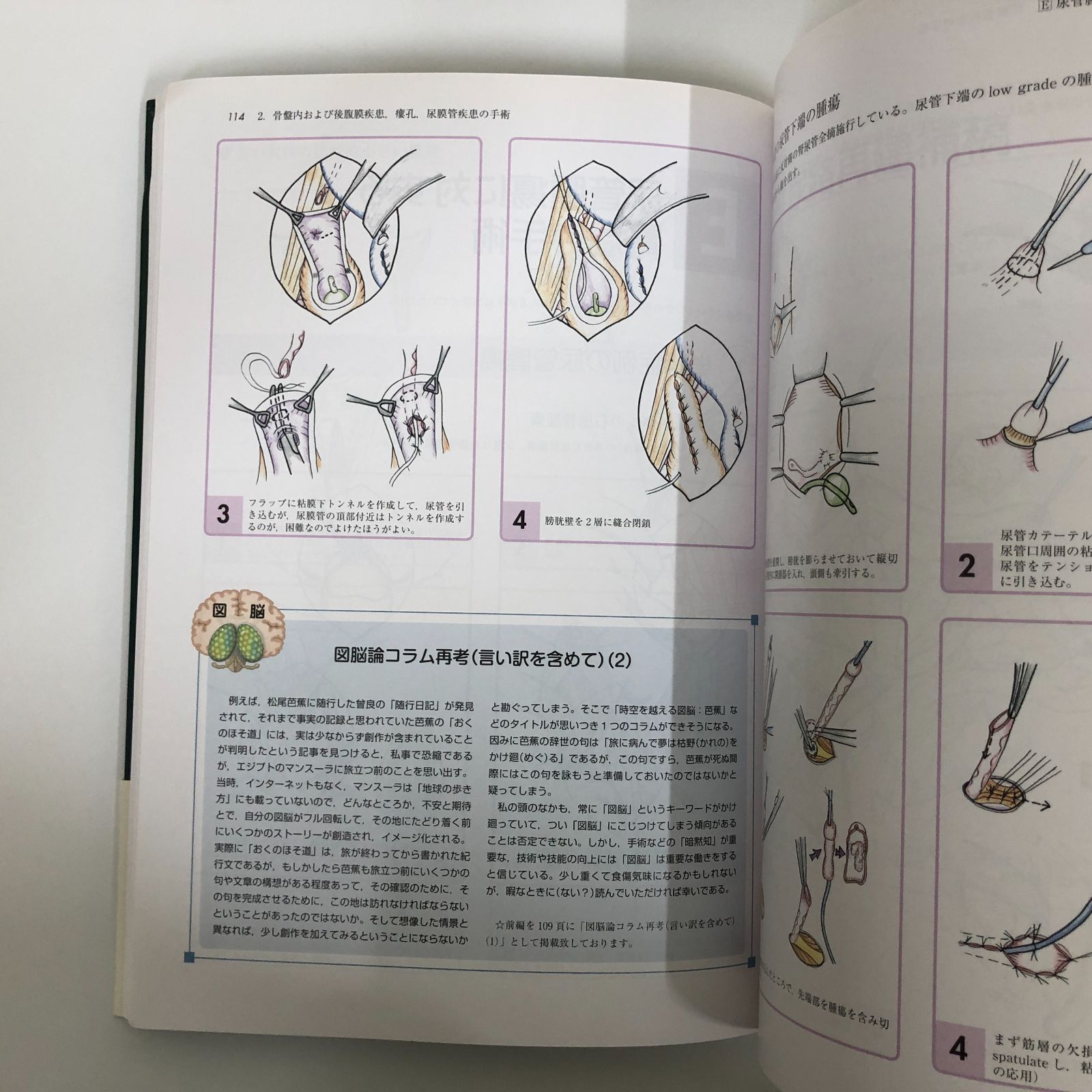 R-4-4260011030]イラストレイテッド泌尿器科手術 頭脳で学ぶ手術の秘訣