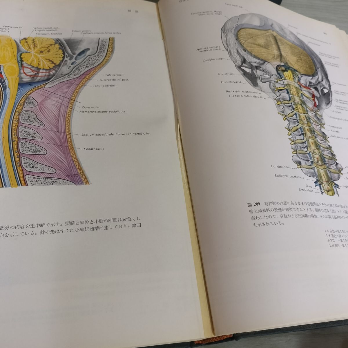 臨床応用局所解剖図譜 (1966年) [古書] Eduard Pernkopf; 小川 鼎三; 石川 浩一 計2冊 臨床応用局所解剖図譜 第1巻 第2巻 1966年 昭和41年 初版 280008