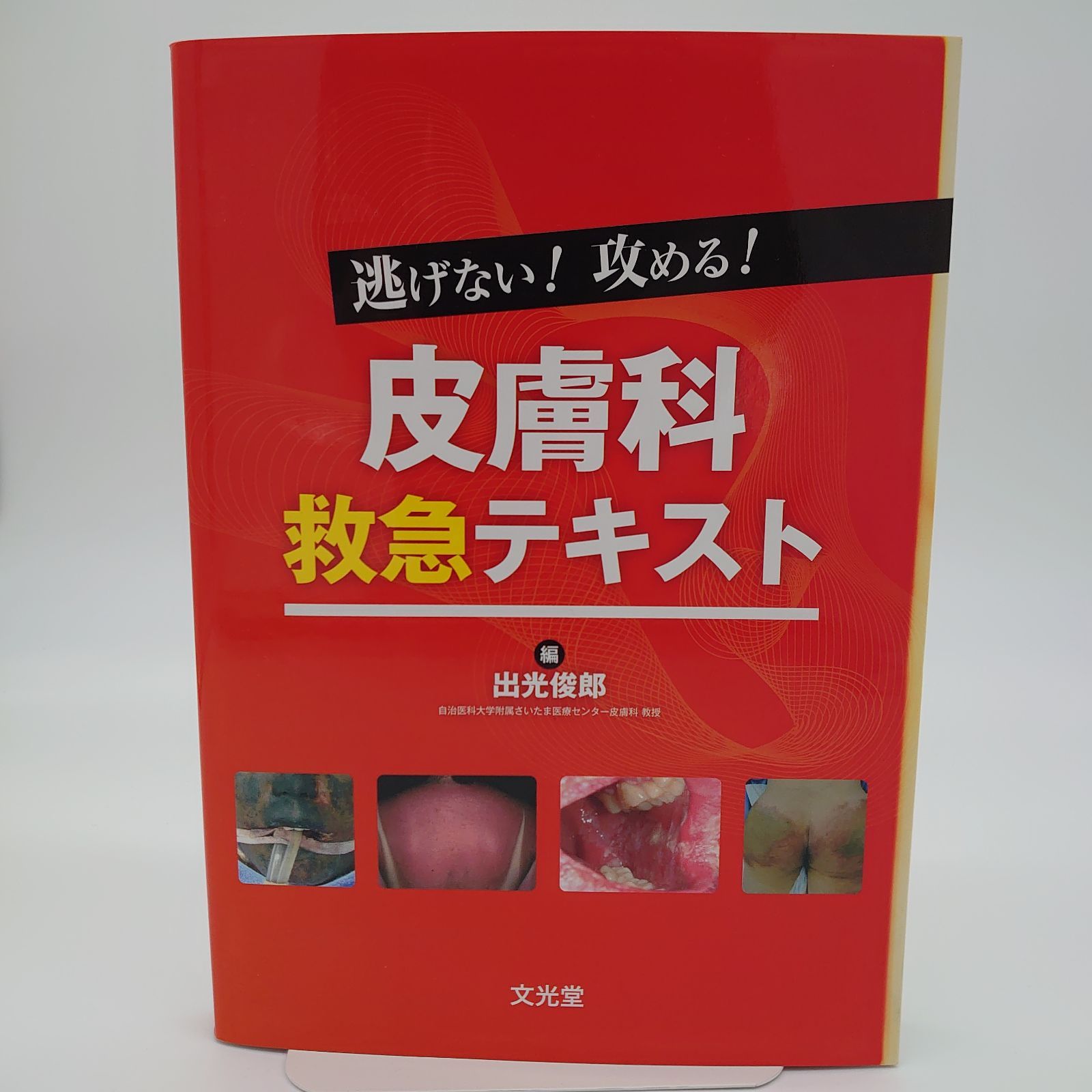 逃げない!攻める!皮膚科救急テキスト - メルカリ