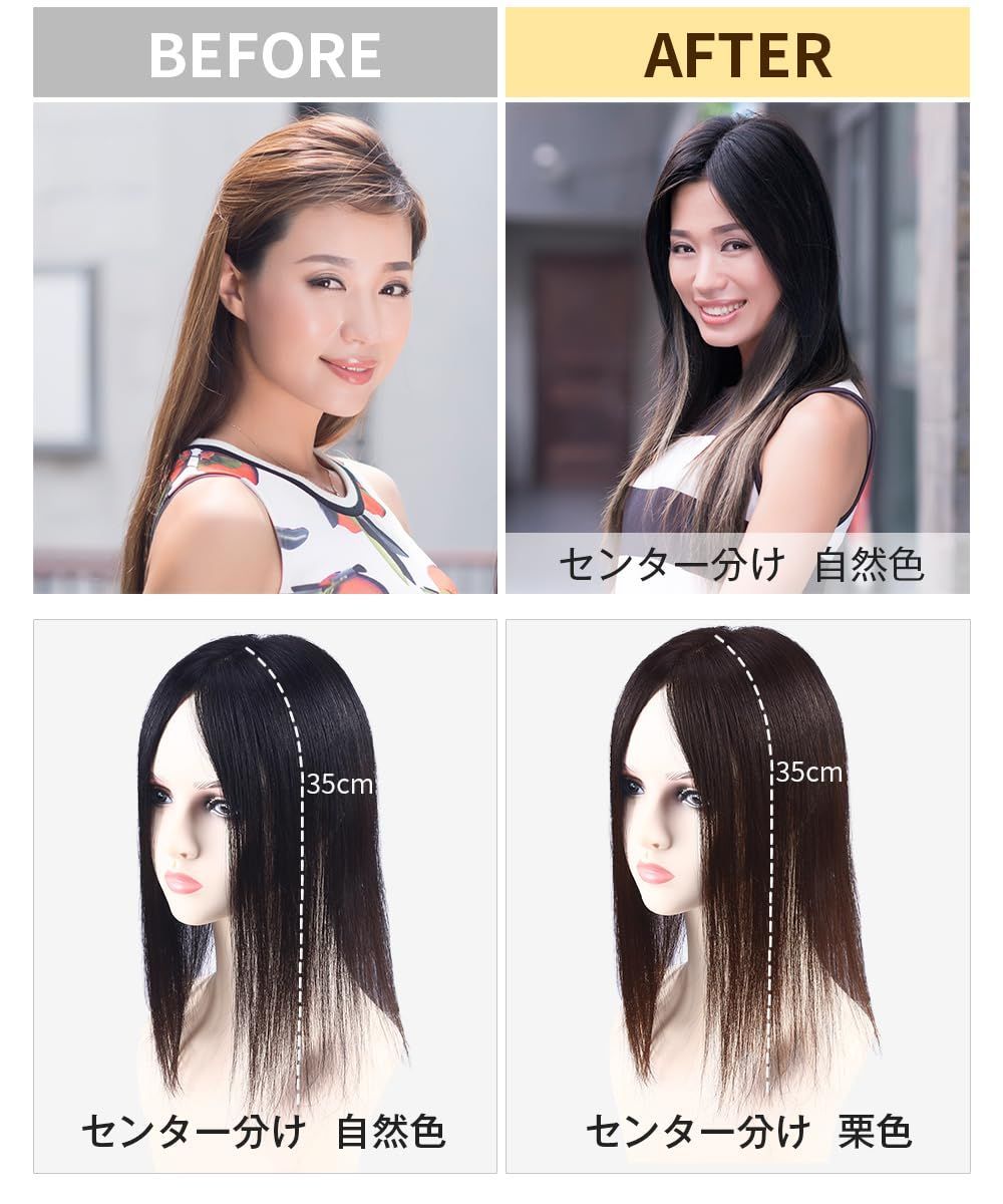 脱毛症 白髪隠し
