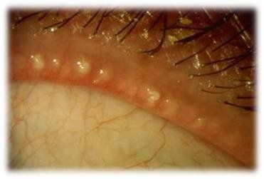12種類成分配合