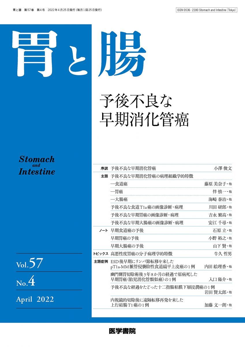 胃と腸 2022年4月号 主題 予後不良な早期消化管癌 [雑誌] 胃と腸 2022年4月号 主題 予後不良な早期消化管癌 [雑誌] - メルカリ