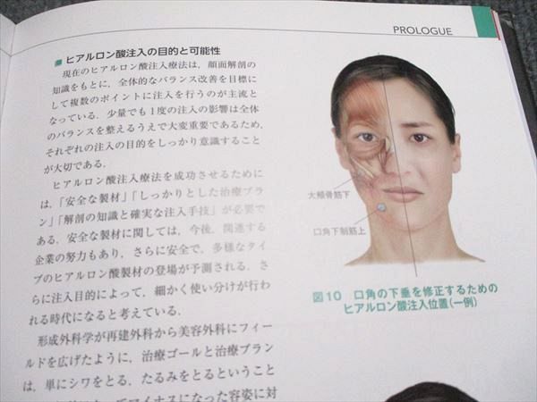 メディカルレビュー社 解剖から学ぶヒアルロン酸注入療法 2020 古山登隆 017S3D Amazon.co.jp: 解剖から学ぶ ヒアルロン酸注入療法 : 古山登隆