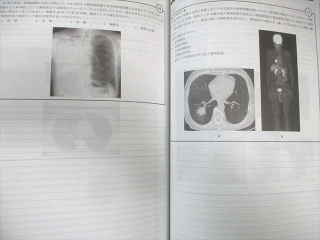 MEC 医師国家試験対策 第117回問題解説講座内科/臓器別講座など 2024年合格目標 計19冊 ★ 250L3D MEC 医師国家試験対策 第117回問題解説講座内科/臓器別講座など