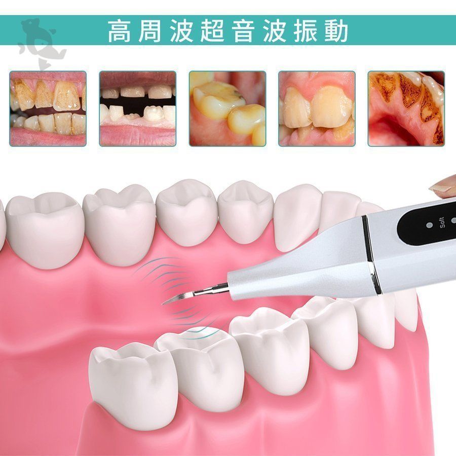 口腔洗浄器 音波 歯石取り 超音波 自分 歯石 除去 電動 スケーラー オーラルケア用品 口臭 歯 ヤニ取り ヤニ取り クリーナー 歯 歯間ブラシ  黄ばみ - メルカリ