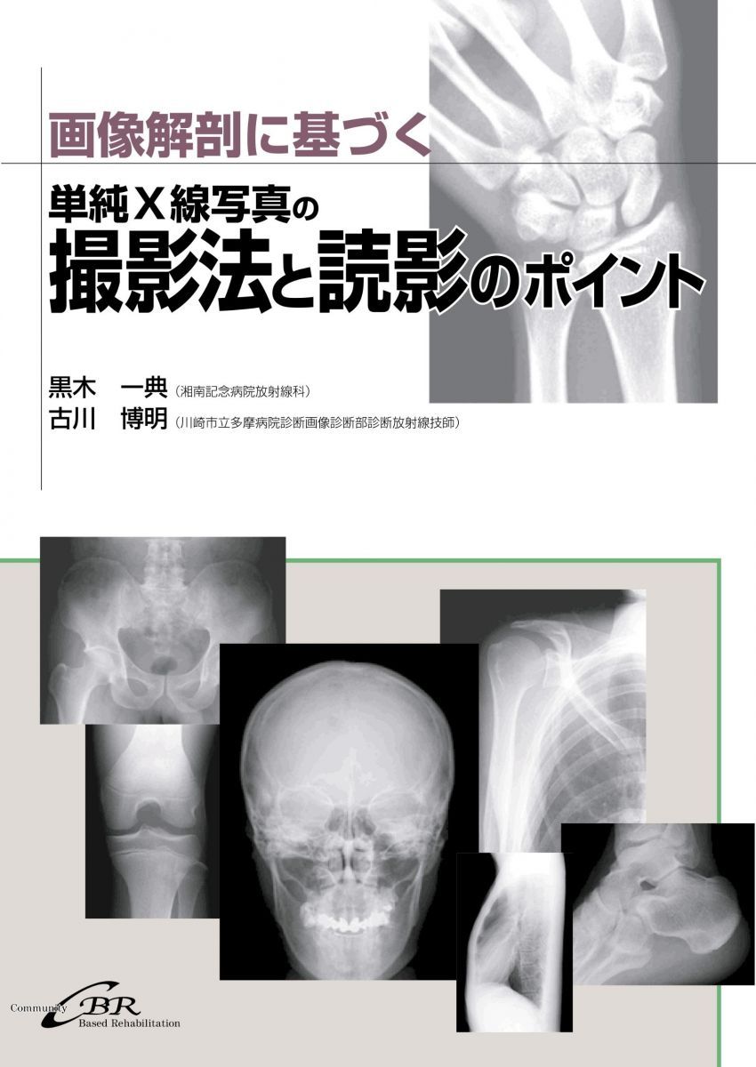 画像解剖に基づく単純X線写真の撮影法と読影のポイント [単行本] 黒木 一典; 古川 博明