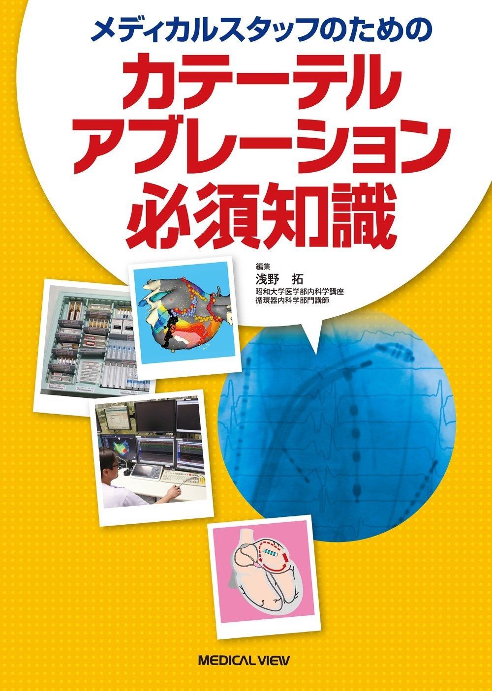 メディカルスタッフのための カテーテルアブレーション必須知識