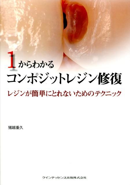 1からわかるコンポジットレジン修復 レジンが簡単にとれないためのテクニック 猪越重久