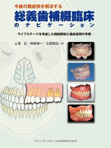 阿部二郎の総義歯難症例 公式ショッピングサイト