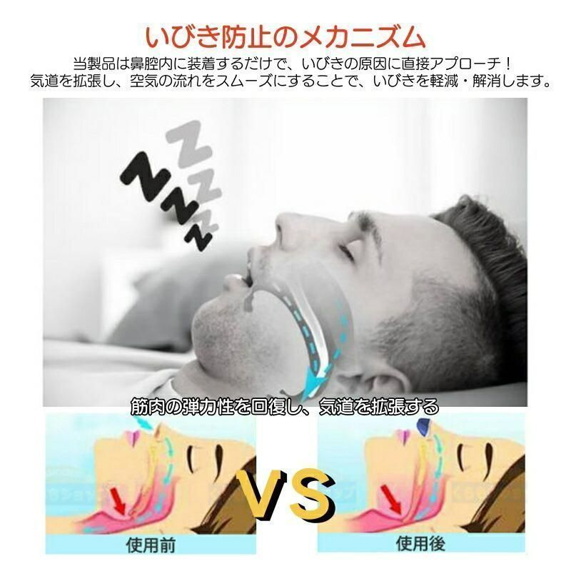 いびき防止 グッズ いびき対策 快眠 いびき軽減 快眠 3個セット いびき防止 グッズ 無呼吸症候群 いびき対策グッズいびき 睡眠