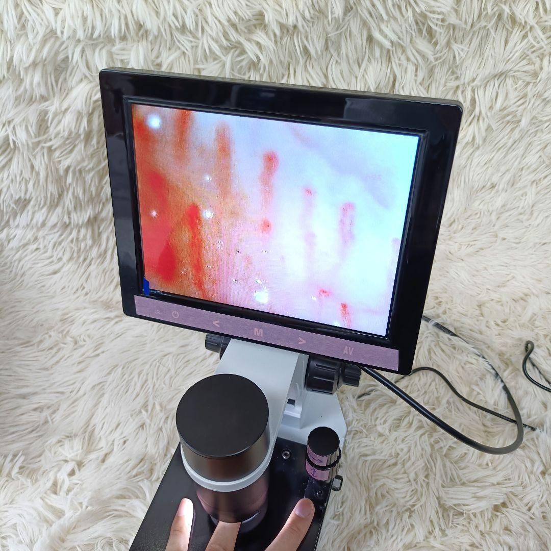 毛細血管スコープ 顕微鏡 電源式 健康管理 血流