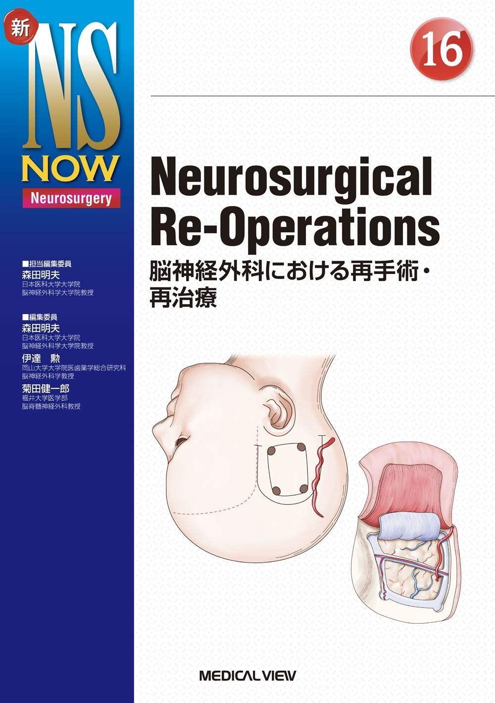 脳神経外科 新NS NOW12 脳神経外科低侵襲手術の今 新NS NOW｜定期購読 - 雑誌のFujisan