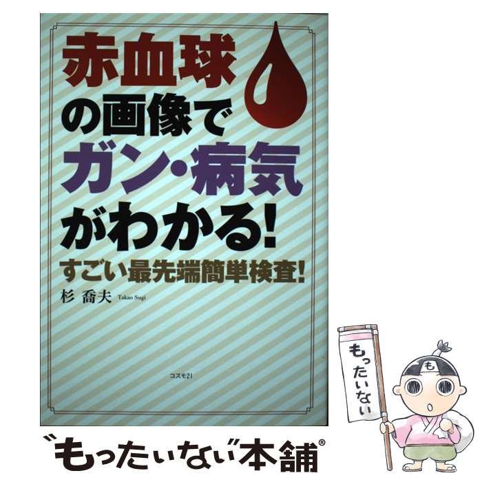 【中古】 赤血球の画像でガン・病気がわかる！ すごい最先端簡単検査！/コスモトゥーワン/杉喬夫 中古】 赤血球の画像でガン・病気がわかる！ すごい最先端簡単検査