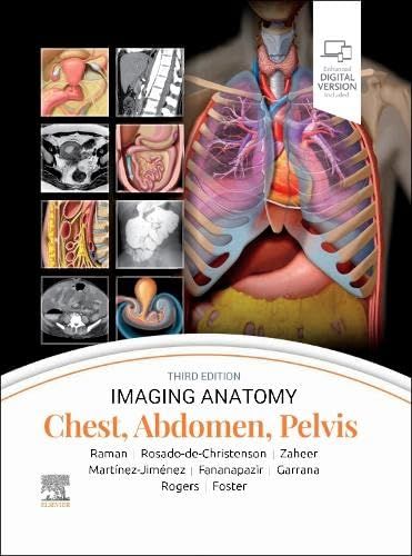 Imaging Anatomy Chest Abdomen Pelvis Siva P. Raman MD Mel