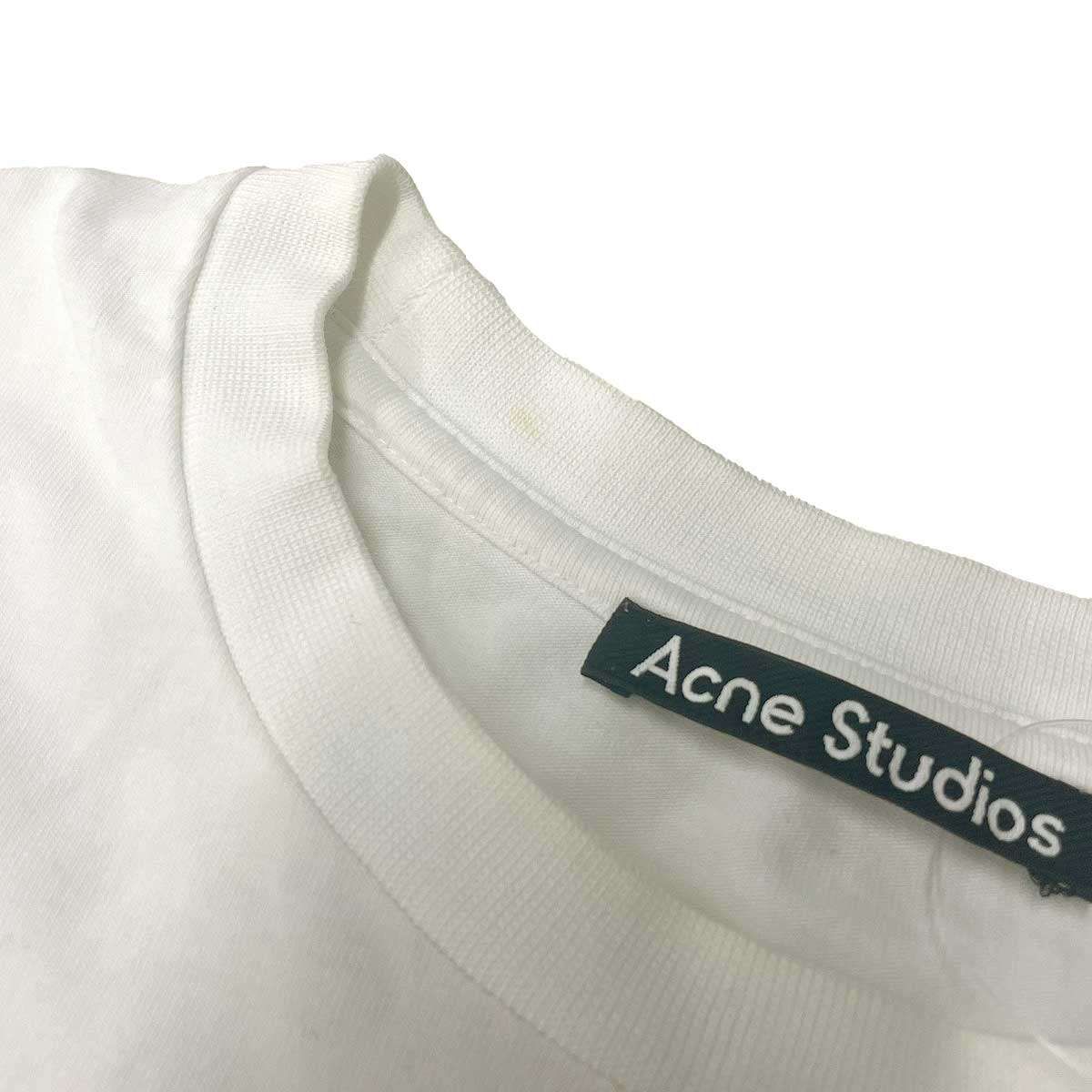 Acne