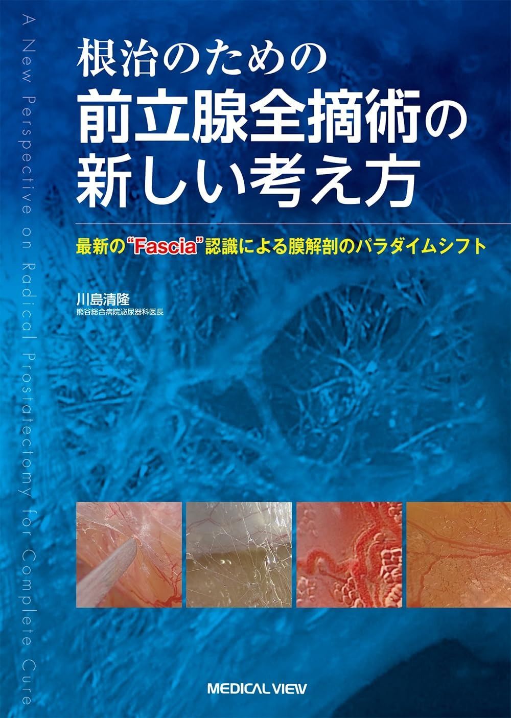 根治のための前立腺全摘術の新しい考え方?最新の Fascia”認識による膜解剖のパラダイムシフト