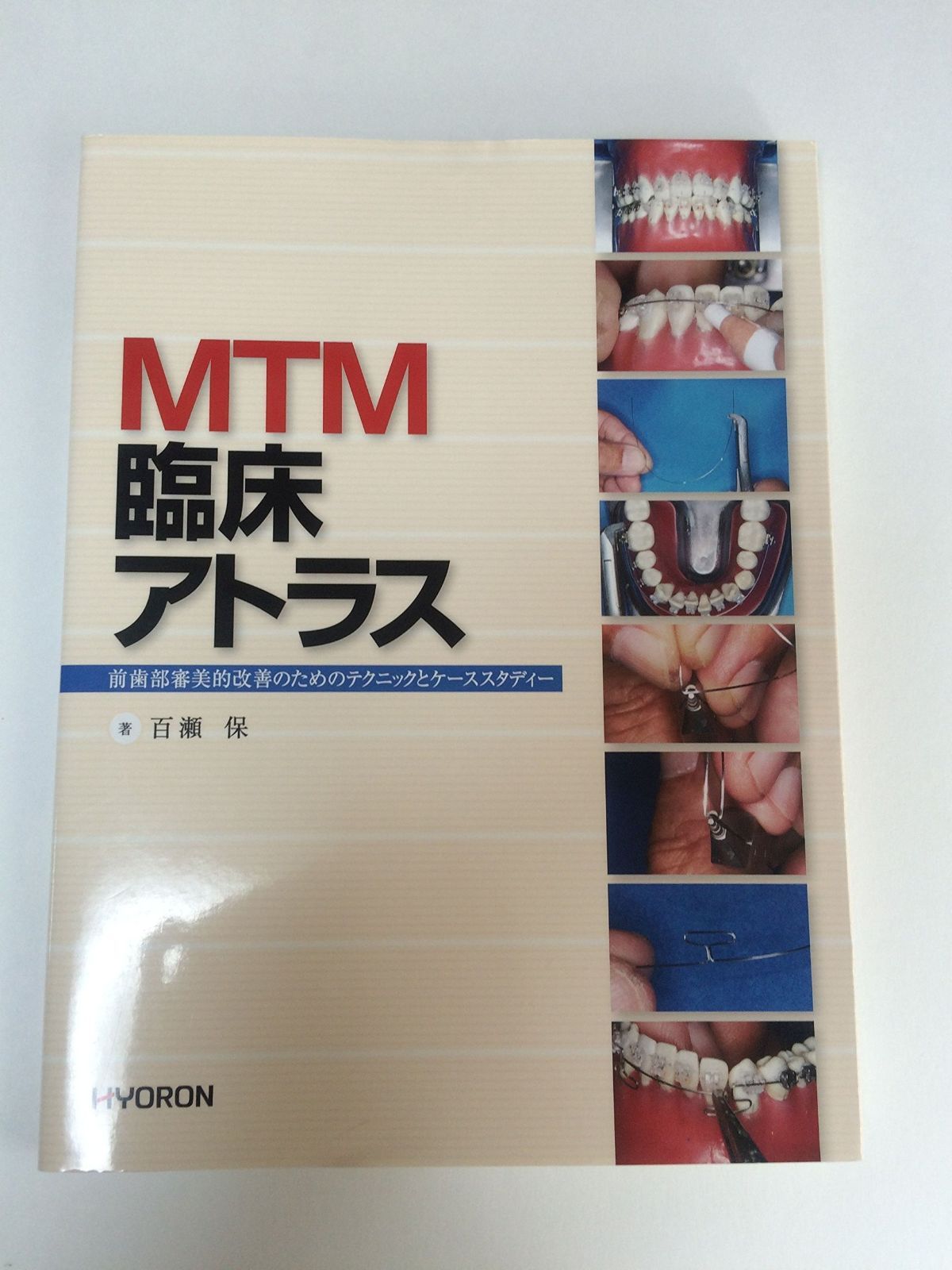MTM臨床アトラス - | 百瀬 株式 カラ-アトラス歯周補綴・治療のためのM.T.M
