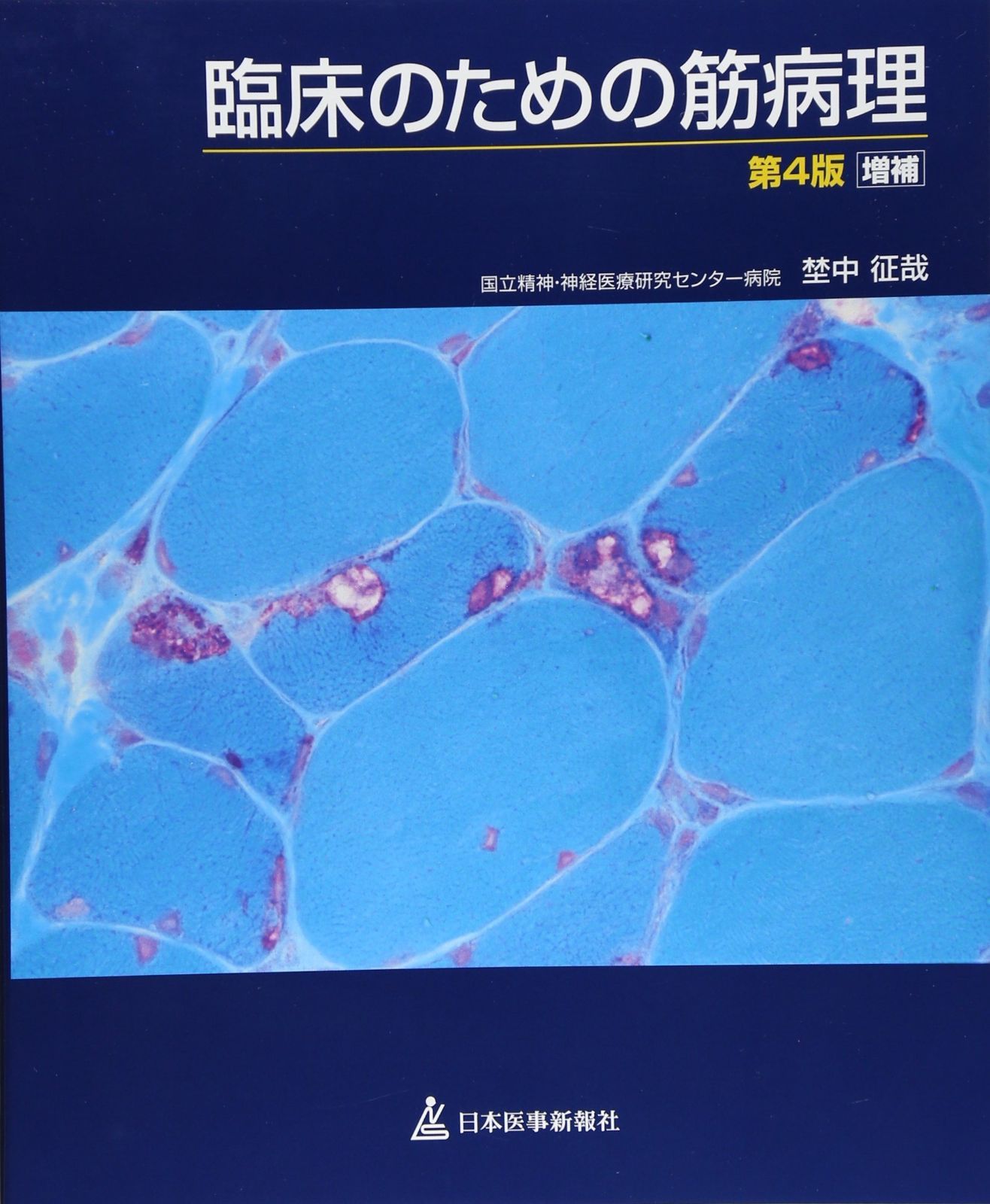 【裁断済み】臨床のための筋病理 臨床のための筋病理<第4版>増補 - メルカリ