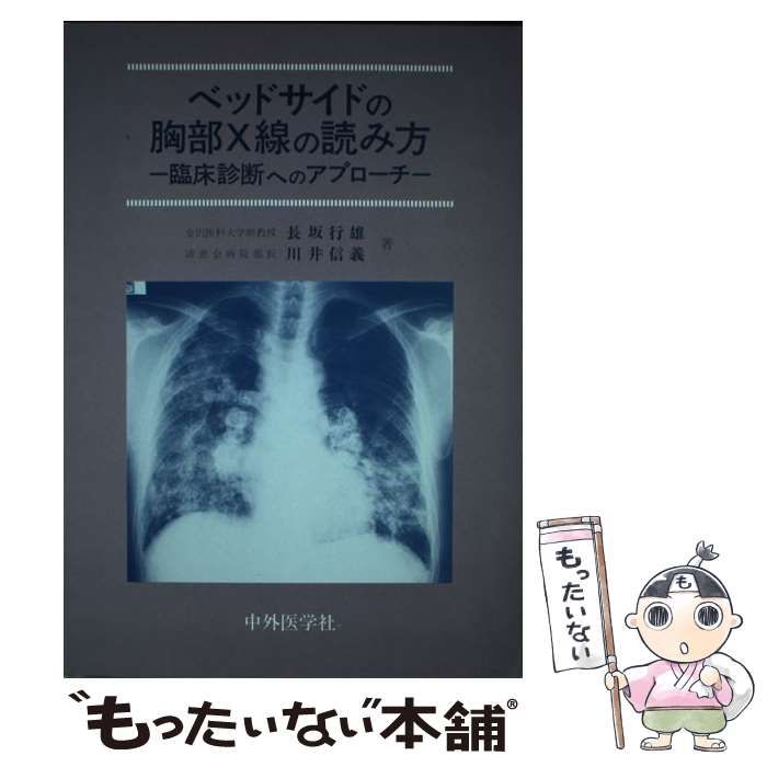 中古】 ベッドサイドの胸部X線の読み方 臨床診断へのアプローチ / 長坂