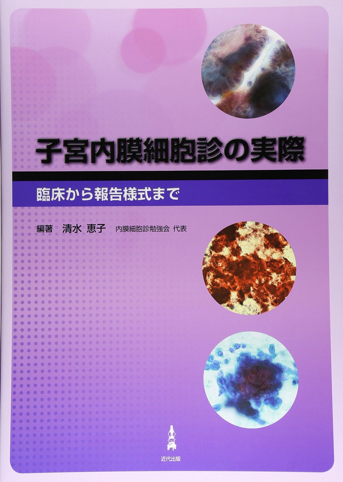 子宮内膜細胞診の実際: 臨床から報告様式まで