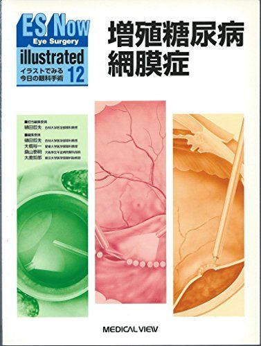増殖糖尿病網膜症 (Eye Surgery Now illustrated) 哲夫， 樋田 増殖糖尿病網膜症 (Eye Surgery Now illustrated) 哲夫， 樋田