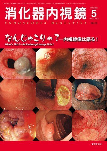 全国無料，人気 消化器内視鏡第24巻5号増大号 なんじゃこりゃ-内視鏡像は語る! (消化器内視鏡2012年5月増大号) 消化器内視鏡編集委員会 語学・辞書・学習参考書