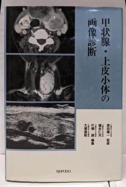 【中古】甲状腺・上皮小体の画像診断／福永仁夫 ほか編／金芳堂 中古】甲状腺・上皮小体の画像診断／福永仁夫 ほか編／金芳堂
