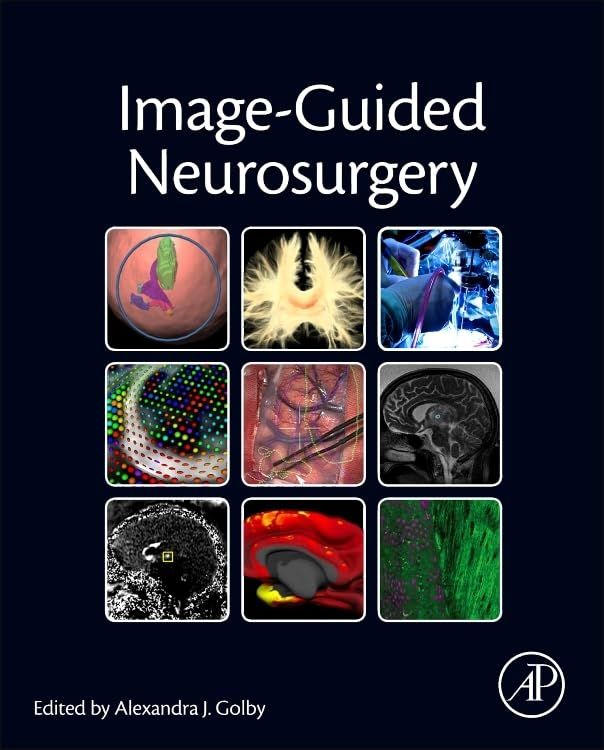  Image-Guided Neurosurgery [ハードカバー] Golby， Alexandra J. 語学・辞書・学習参考書