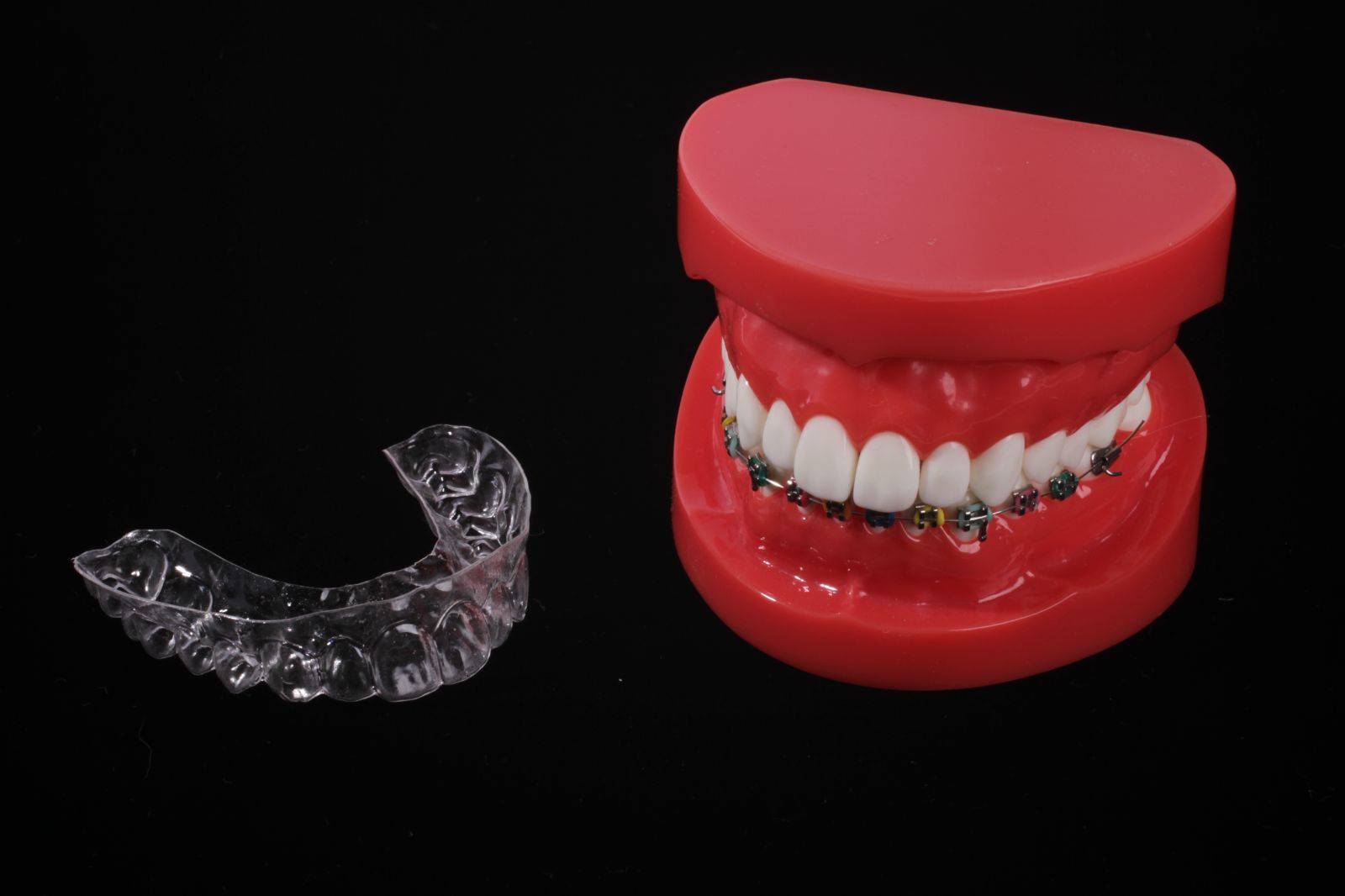 歯列矯正見本模型