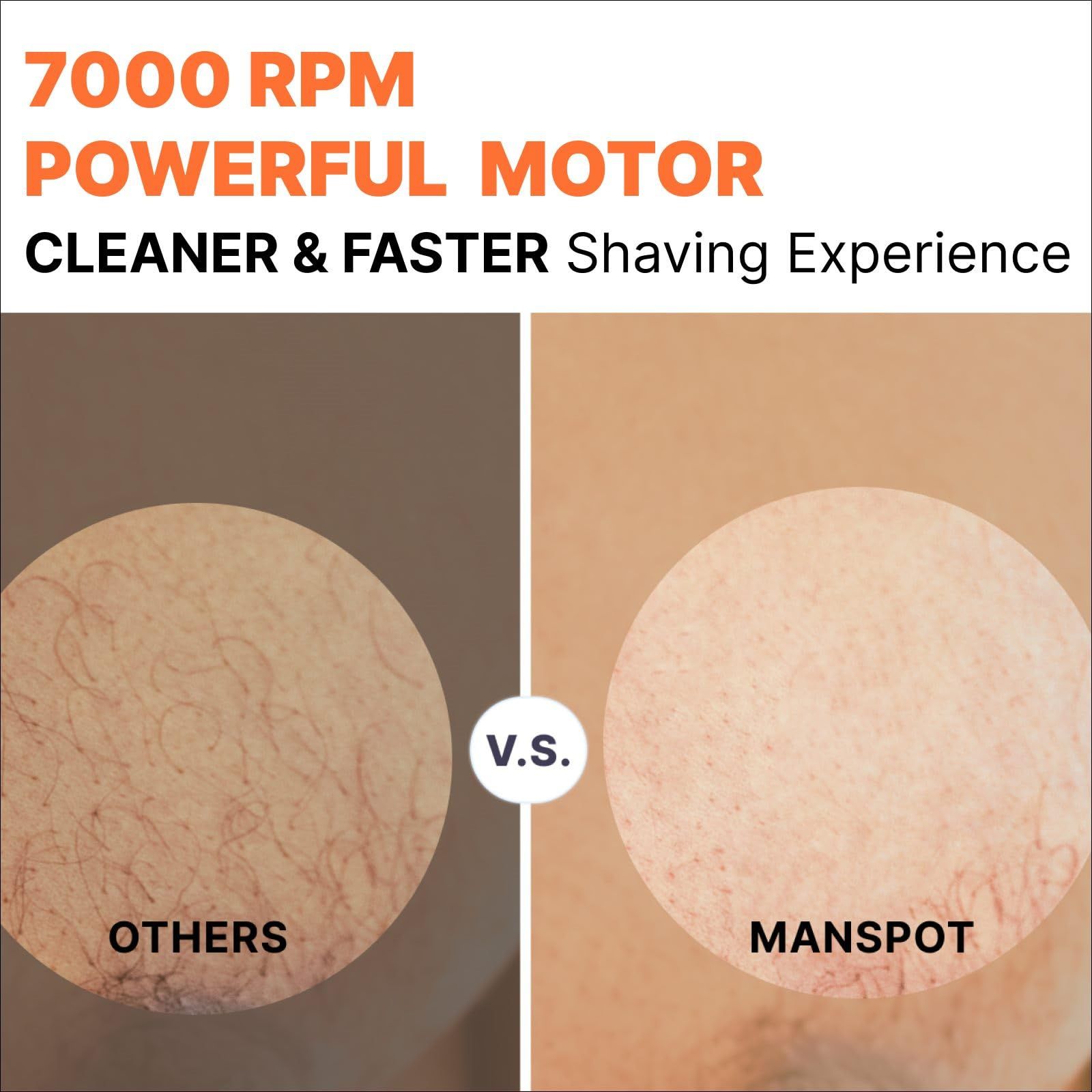MANSPOT Groin Hair Trimmer for Men Electric Ball Trimmer|Shaver Replaceable Ceramic Blade Heads Waterproof Wet|Dry Groin - Bod WWW_OLIVIERBERNSTEIN_COM