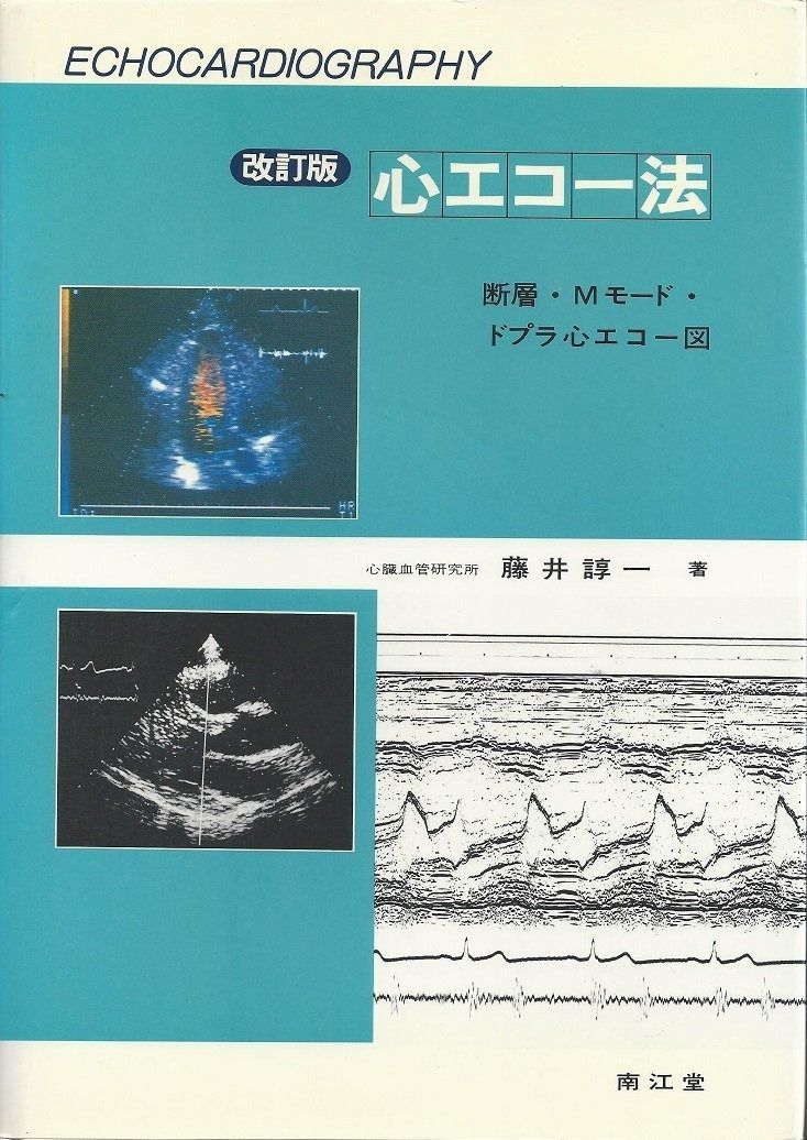 心エコー法―断層・Mモード・ドプラ心エコー図