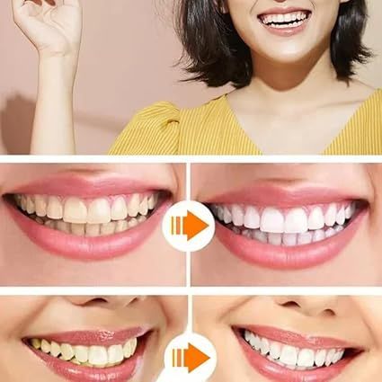 入れ歯 義歯 上下の歯用 上歯+下歯セット 2組入り 美容 付け歯 入れ歯 義歯 上下の歯用 上歯+下歯セット 2組入り 美容 付け歯