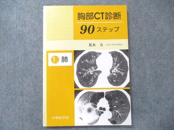 TZ91-061 中外医学社 胸部CT診断 90ステップ 1肺 第1版第4刷 1998 荒木