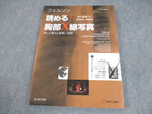 診断と治療社/ELSEVIER フェルソン 読める！胸部X線写真 楽しく