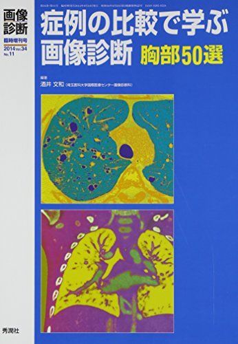 症例の比較で学ぶ画像診断 胸部50選 酒井文和