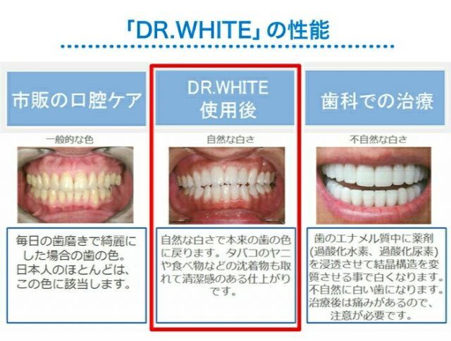 ホワイトニング セルフケア