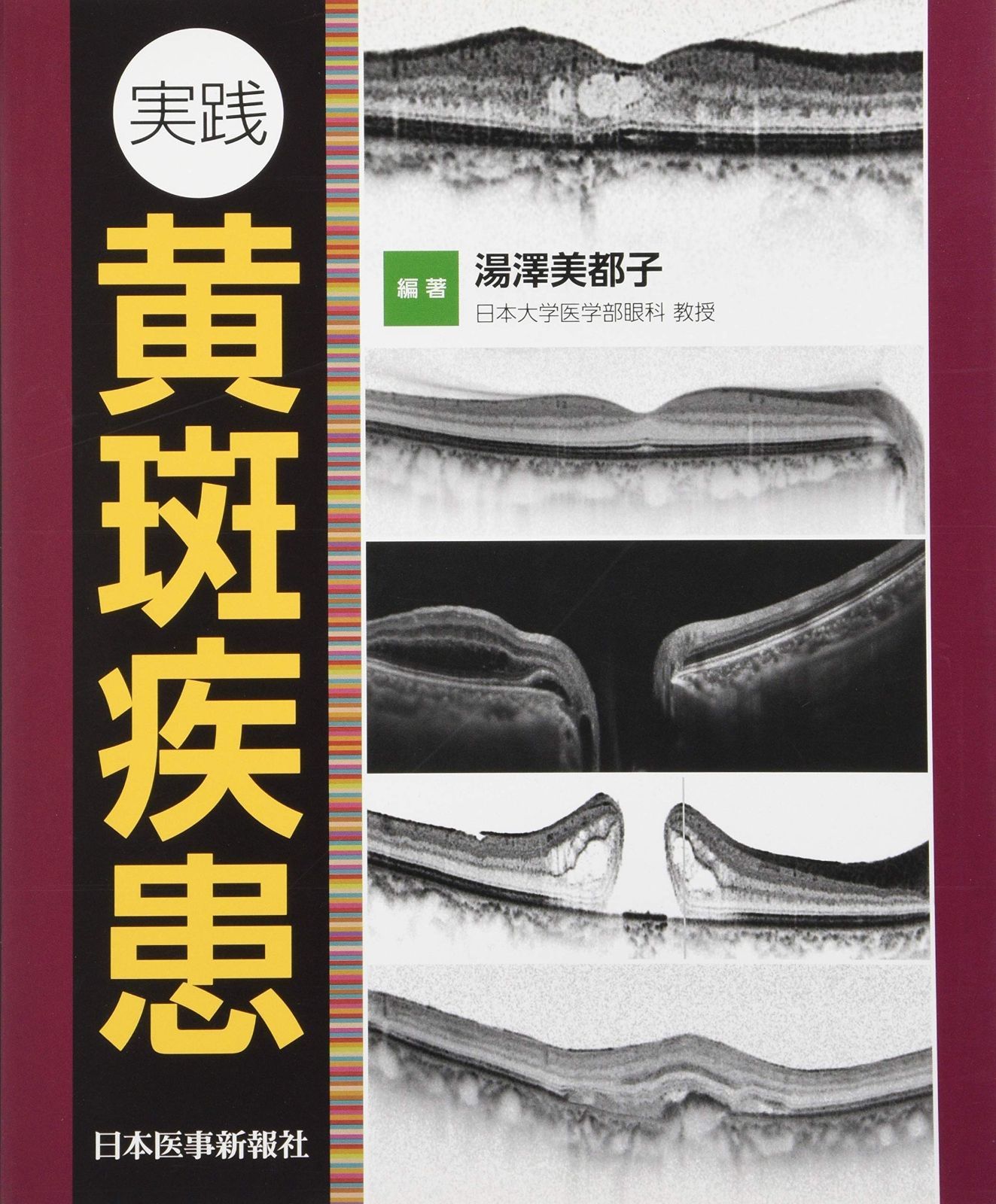 黄斑疾患診療AtoZ 第2版 Amazon.co.jp: 黄斑疾患診療AtoZ 第2版 (眼科臨床エキスパート) : 岸