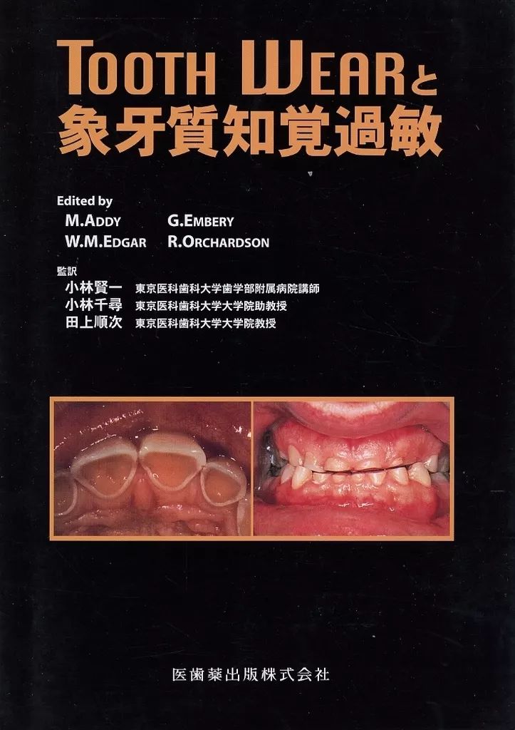 単行本 実用 ≪医学≫ TOOTH WEARと象牙質知覚過敏
