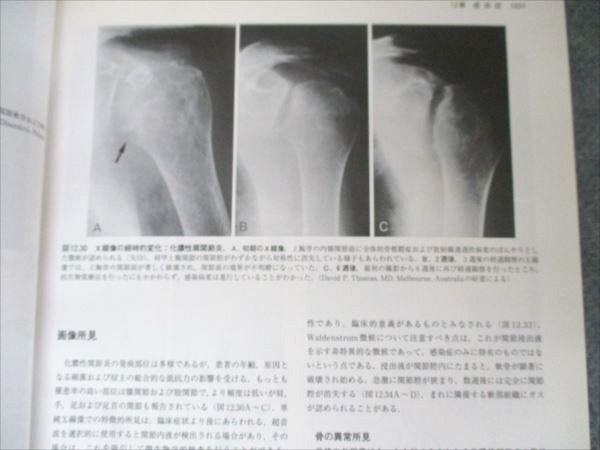 骨 関節の画像診断IV